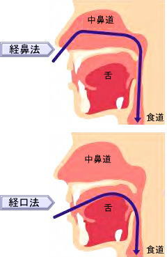 経鼻法と経口法